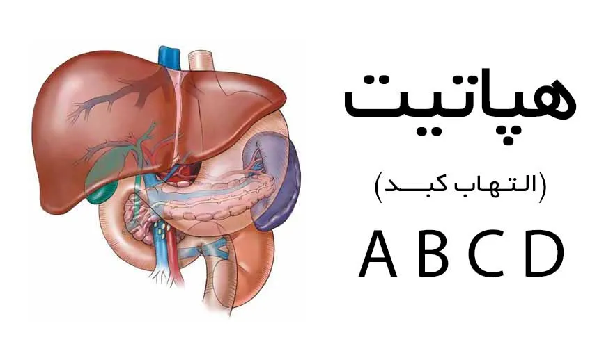 روز جهانی هیپاتیت یا زردی سیاه و افزایش این بیماری در کشور